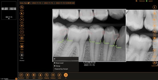 Apteryx Imaging: Dental Imaging Software
