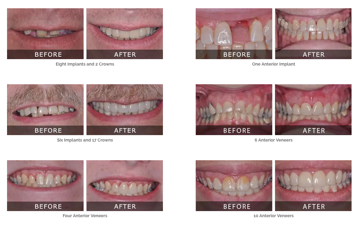 Before and After Marketing