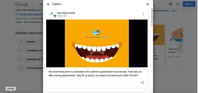 A dental practice update shown in the Updates panel of its Google Business Profile on Google Search