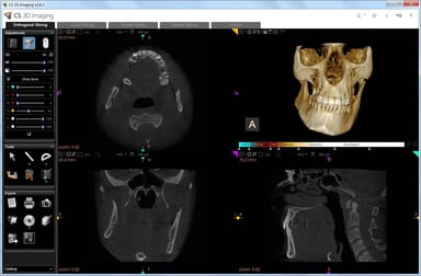 Carestream Dental Imaging: Dental Imaging Software