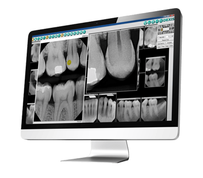 DEXIS Imaging Suite Software: Dental Imaging Software