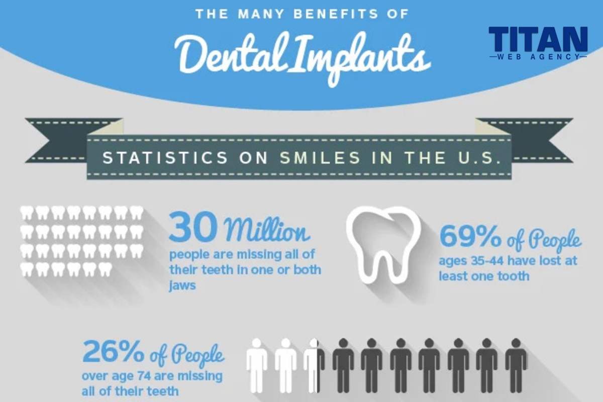 7 Dental Implant Marketing Ideas That Get Results
