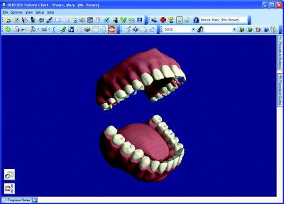 Dentrix-3D-Chart-Mouth Dentrix (by Henry Schein) Dental Practice Management Software
