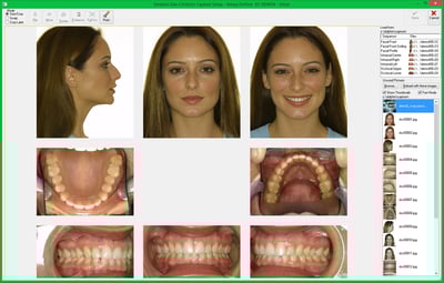 Dolphin Imaging Plus: Dental Imaging Software