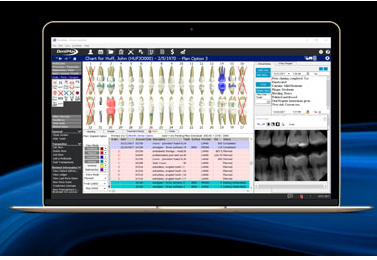 dentimax dentimax software screenshot