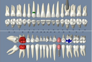 open dental pricing
