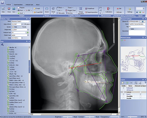 Planmeca Romexis Dental Imaging Software
