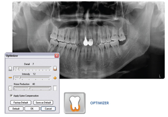 VixWin Platinum: Dental Imaging Software
