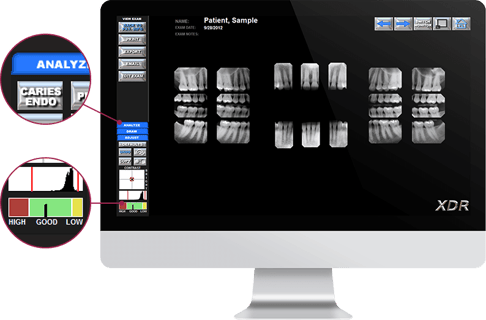 XDR Dental Imaging Software