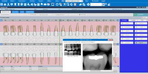 Denticon by Planet DDS Dental Practice Management Software