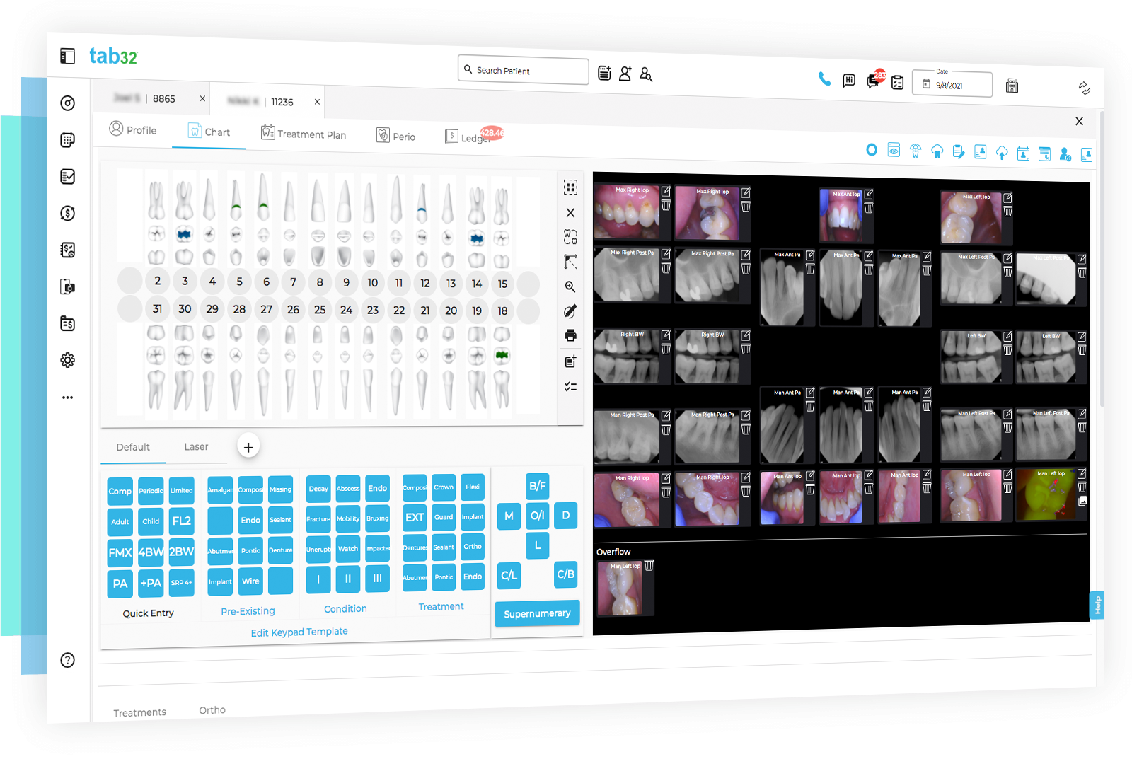 open dental vs eaglesoft