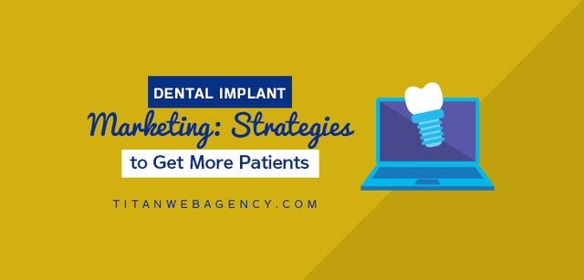 4 Tips to Better Dental Implant Marketing